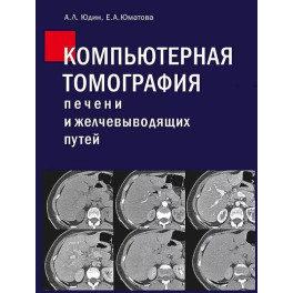 Компьютерная томография печени и желчевыводящих путей: практическое руководство